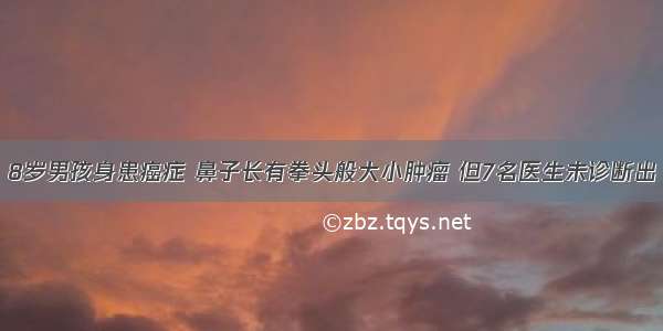 8岁男孩身患癌症 鼻子长有拳头般大小肿瘤 但7名医生未诊断出