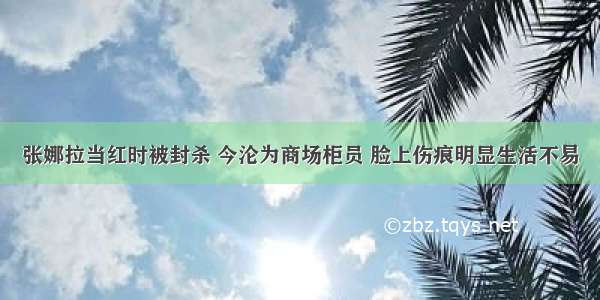 张娜拉当红时被封杀 今沦为商场柜员 脸上伤痕明显生活不易